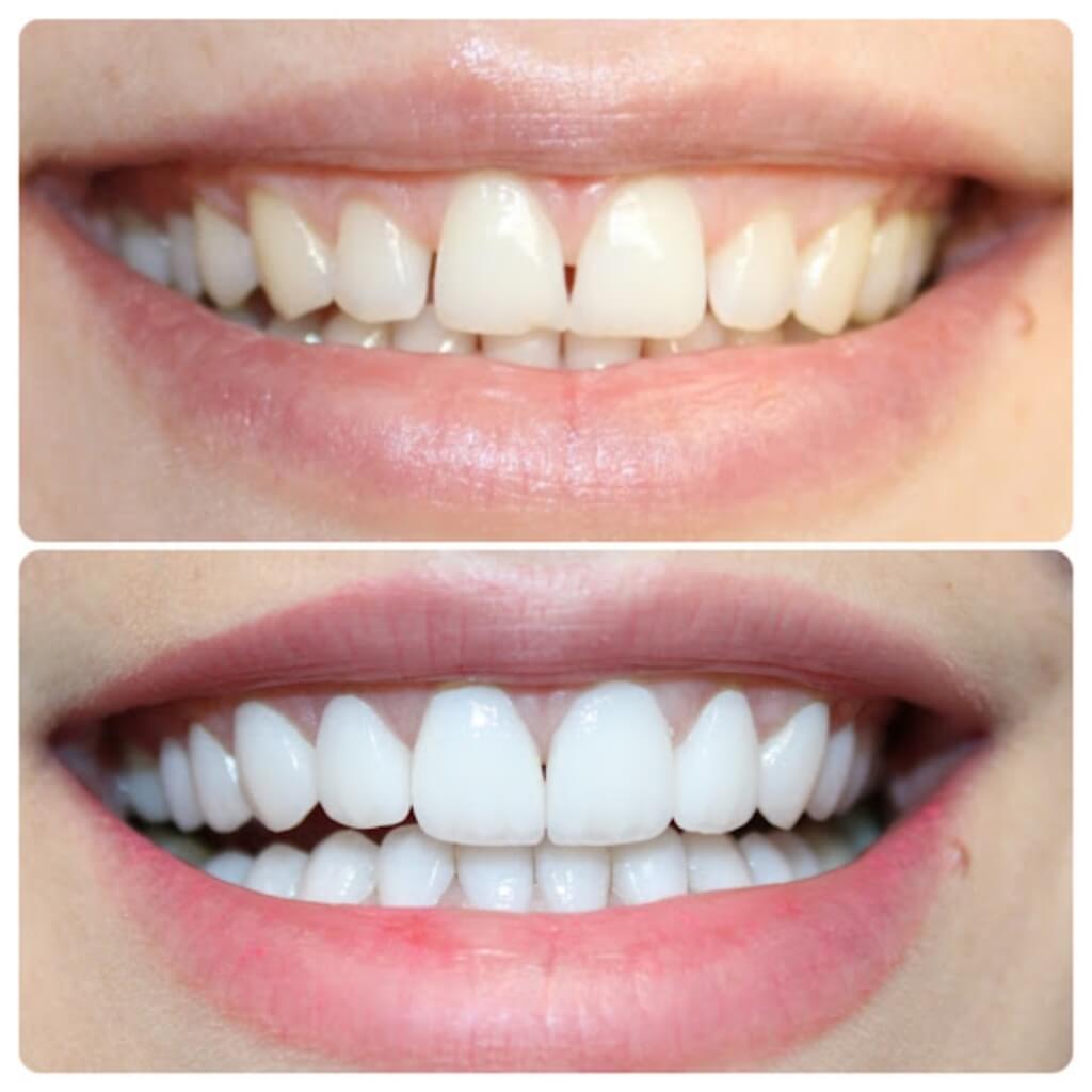 Brickell Dental Care 3