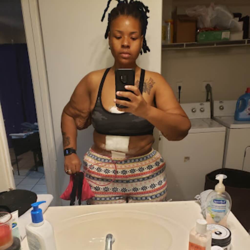 PROFESSIONAL PLASTIC SURGERY, INC