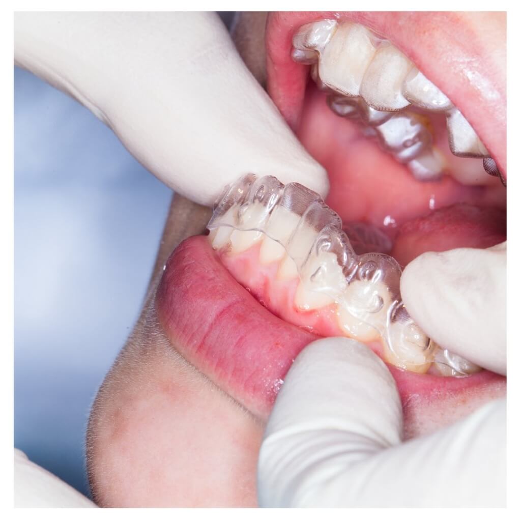 Creative Orthodontic Associates 4