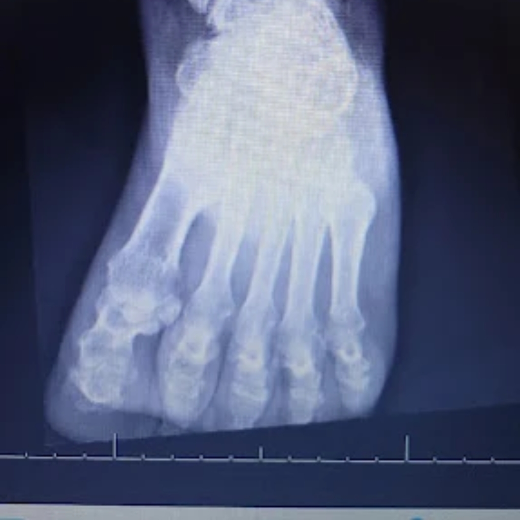 Southernmost Foot and Ankle Specialists consultorio