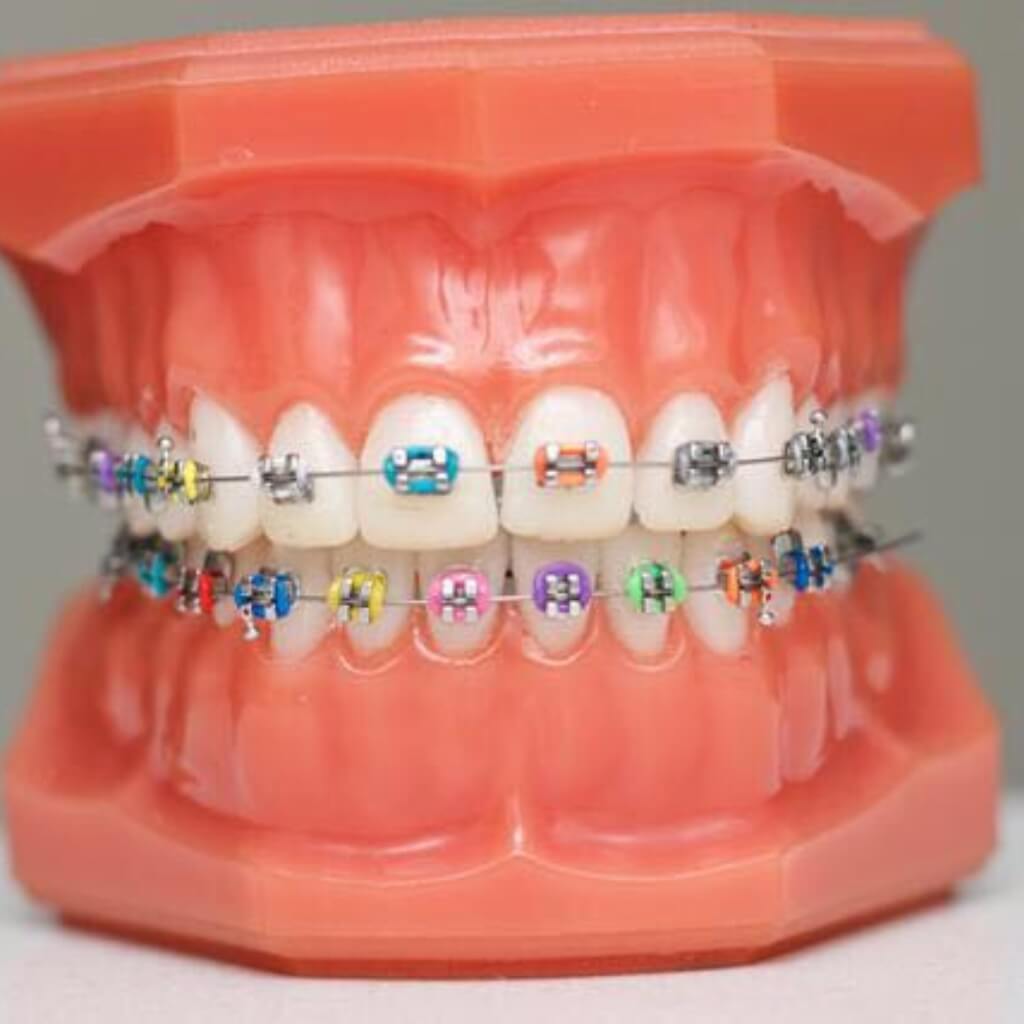 Prótesis en Miami Bay Oral Health