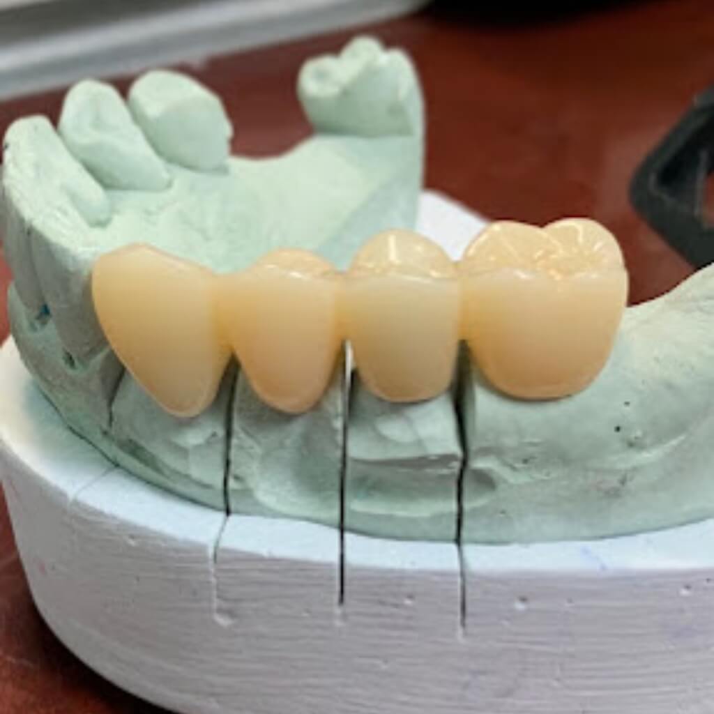 Prótesis garantizada - Dental Lab Corazón De Jesús