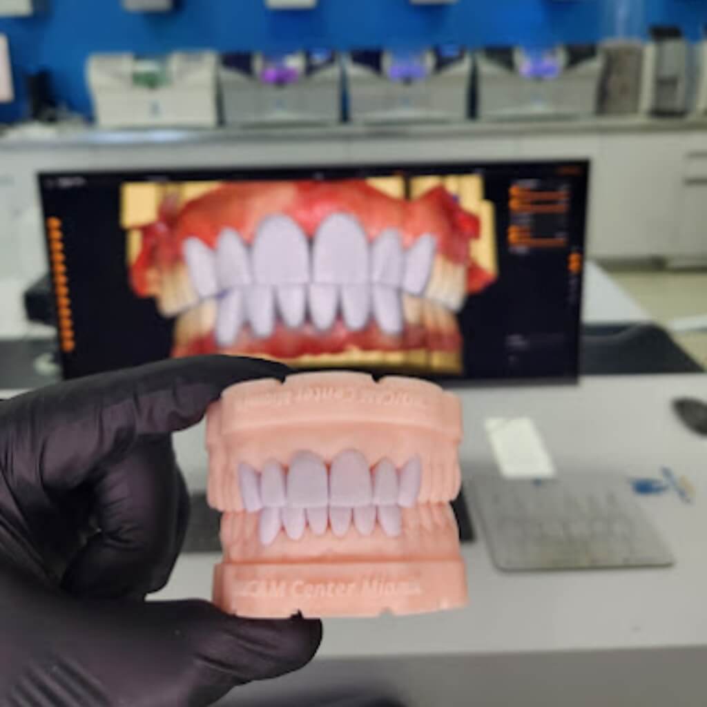 Prótesis de CAD/CAM CENTER Miami