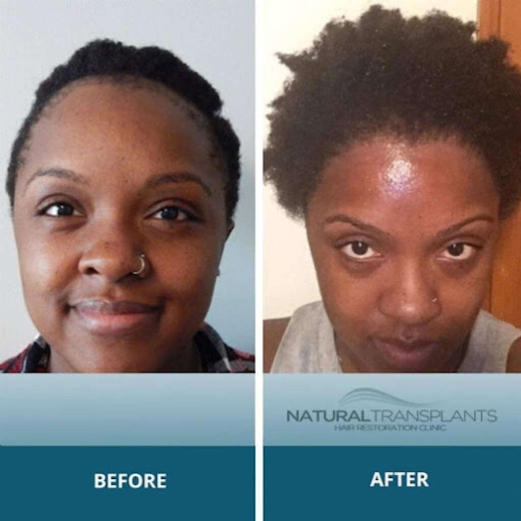 Médicos Natural Transplants