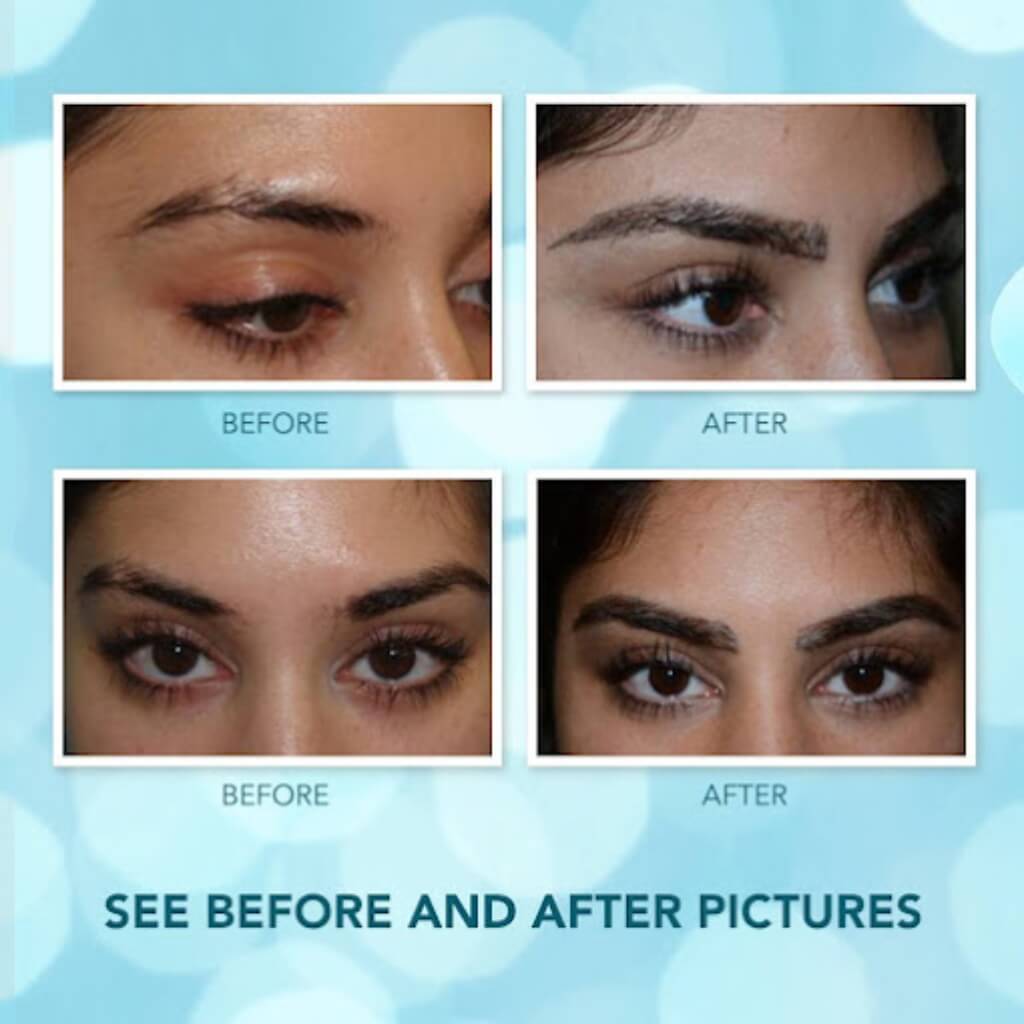 Tratamiento Foundation For Hair Restoration